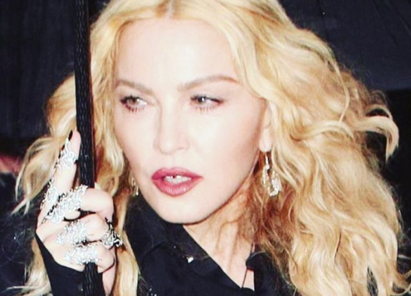 El costoso tratamiento de Madonna para las arrugas