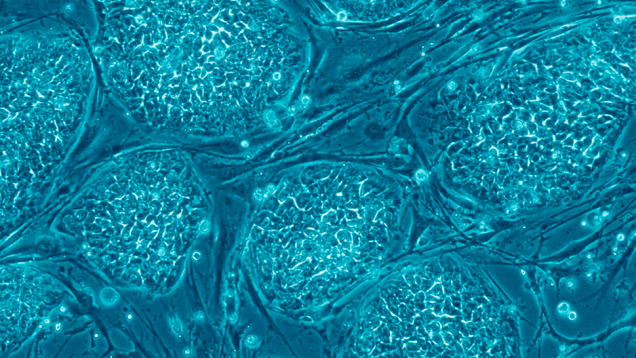 La fusión de células normales puede desencadenar procesos cancerígenos