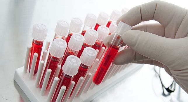 Un análisis de sangre descubre todos los virus que han afectado a una persona