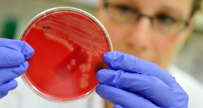 Nueva &#039;superbacteria&#039; resistente a antibióticos alerta a científicos