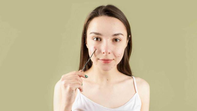 Combatir el acné cuidando el microbioma de la piel