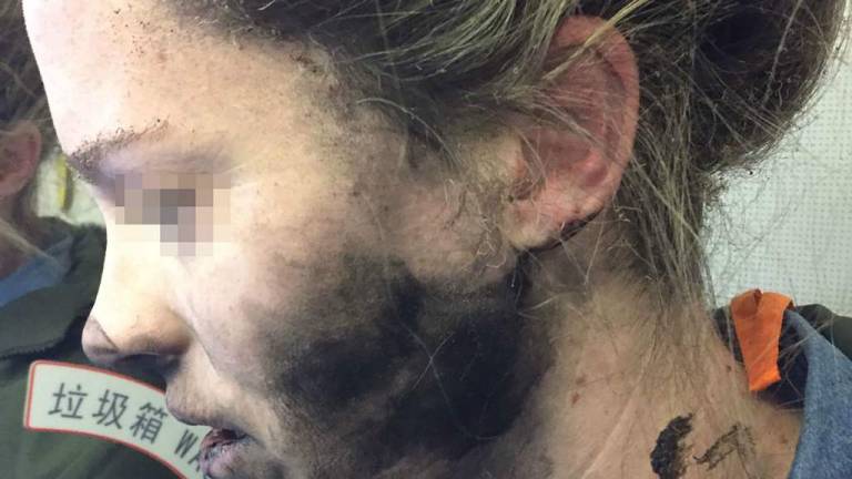 Mujer sufre quemaduras por explosión de sus auriculares en un vuelo
