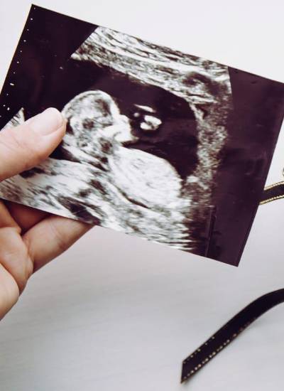 En el Ecuador, en el 2024, se registraron 1.137 muertes neonatales (hasta los 28 días de nacidos) según datos del Ministerio de Salud Pública.