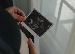 Imagen referencial de una joven madre viendo la captura de una ecografía mientras está embarazada.