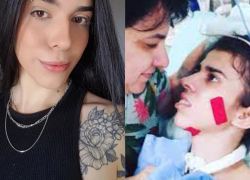 Thais, antes y después del incidente que despertó una reacción alérgica en ella.
