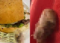 Mujer halla un dedo humano dentro de una hamburguesa en un restaurante de Bolivia.