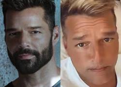 Ricky Martin dijo que no se ha hecho nada en la cara.