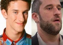 &quot;Screech&quot;, de &quot;Salvado por la campana&quot;, está hospitalizado por cáncer