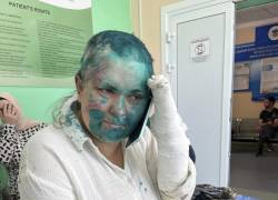 Una foto proporcionada por Sergei Babinets, el líder de Crew Against Torture, muestra a la periodista rusa Yelena Miláshina, herida como resultado de un ataque de hombres enmascarados desconocidos, hablando por teléfono con la Comisionada de Derechos Humanos de la Federación Rusa Tatyana Moskalkova.