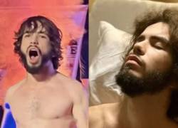 Joven fue sometido a cirugía por el uso excesivo del cigarrillo electrónico.