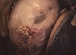 Extraordinario video un bebé nacido con su bolsa amniótica intacta