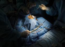 Foto referencial: Una operación a un paciente afectado por mucormicosis en la ciudad india de Ghaziabad.