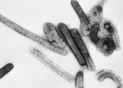 Guinea Ecuatorial confirmó el lunes su primer brote de la enfermedad del virus de Marburgo en la provincia de Kié-Ntem.