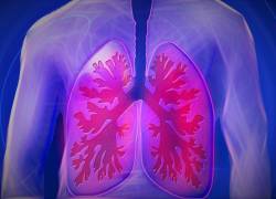 Esta metodología pulmonar es un conjunto de actividades que ayudan a mejorar la capacidad funcional general.