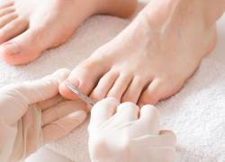 Referencial. Tuvieron que amputarle una pierna después de hacerse una pedicura.