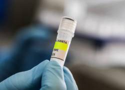 Esta imagen difundida por el Ministerio de Salud de Argentina muestra a un científico del Instituto Malbrán sosteniendo un contenedor utilizado para diagnosticar el hantavirus Andes.