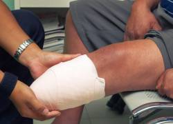 Una cirujana fue condenada este miércoles en Austria por haberle amputado a un paciente la pierna equivocada.