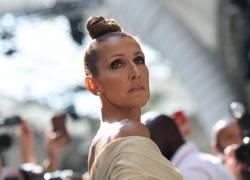 “Ha perdido el control de sus músculos”: hermana de Céline Dion asegura que la salud de la cantante empeora