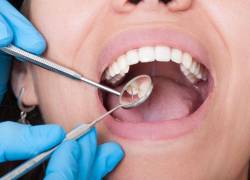 Las infecciones en la boca y la falta de piezas dentales también pueden afectar diversos órganos y sistemas del cuerpo.