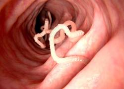 La enfermedad se conoce como Equinococosis Alveolar y ya se conocen casos en norteamérica.