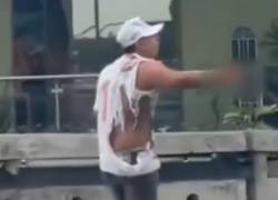 Fotografía que muestra a la víctima luego de la explosión.