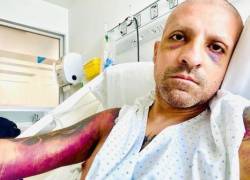 En su confesión pública, se aclaró que sufre de otra patología sobre la que existe un gran estigma,