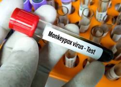 La enfermedad es endémica de África occidental y central, aunque en el actual brote por primera vez se han producido transmisiones en otras regiones.