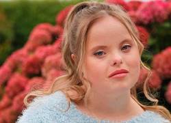 Modelo con síndrome de Down iniciará su carrera tras firmar con una importante agencia