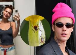 ¿Qué es el Lyme? la enfermedad causada por una garrapata que padecen celebridades como Bella Hadid y Justin Bieber