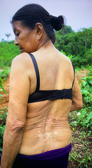 $!Habitantes del sector presentan problemas en la piel, que dicen es producto de las aguas contaminadas de los ríos. Foto: Cortesía.
