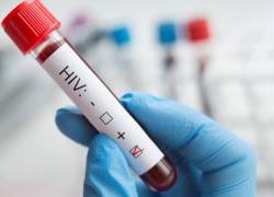 ¿Por qué se lograron en meses las vacunas covid y aún no hay una para el VIH?