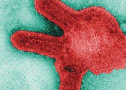 Una imagen microscópica del virus de Marburgo.