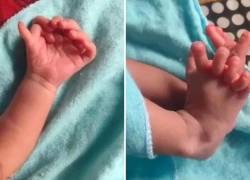 Extraño nacimiento de una bebé con 26 dedos en manos y pies: su familia considera que es la reencarnación de una diosa