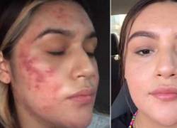 Foto: Tik Tok @fatysinfiltros