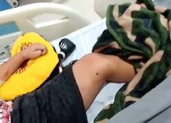 Denuncian demora en cirugía para niño con bala en la pierna; hospital se pronuncia