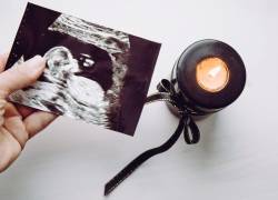 En el Ecuador, en el 2024, se registraron 1.137 muertes neonatales (hasta los 28 días de nacidos) según datos del Ministerio de Salud Pública.