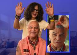 Carlos Valderrama revela que uso peluca postiza.