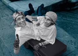 José Luis y José Armando Cevallos los siameses de Ecuador.