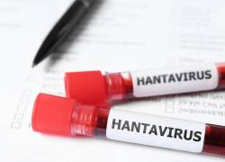 Imagen de muestras de sangre infectadas con hantavirus. En Venezuela ya hay tres casos de personas fallecidas por este virus.