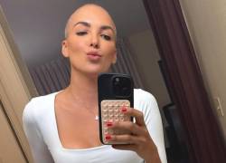 La atleta se encuentra en la etapa de mantenimiento de su tratamiento médico.