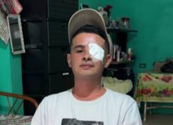 Erick Coello asegura que fue herido por explosiones en altamar.