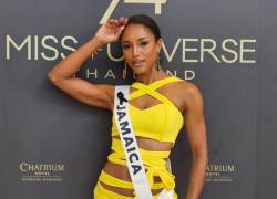 La modelo continúa recuperándose tras el accidente.