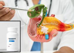El tratamiento será desarrollado por la start-up estadounidense Revolution Medicines, bajo el nombre comercial Rasonque.