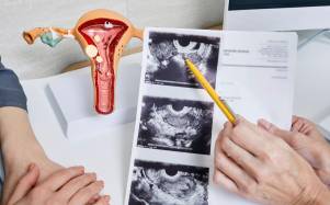 Mujer en consulta ginecológica.