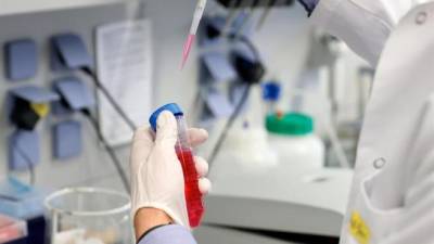 ¿Por qué se está exigiendo un método estándar para evaluar las vacunas? ¿Por qué se está exigiendo un método estándar para evaluar las vacunas?