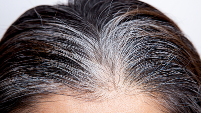 Descubren antioxidante que podría prevenir la aparición de canas Descubren antioxidante que podría prevenir la aparición de canas