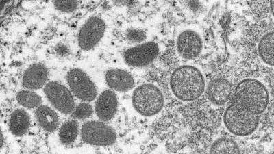 Viruela del Mono: así nació, mutó en una nueva variante y se propaga la amenaza llamada clado 1b Viruela del Mono: así nació, mutó en una nueva variante y se propaga la amenaza llamada clado 1b