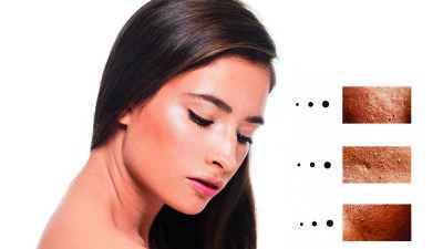 Te dejamos 5 respuestas sobre cómo evitar las manchas en tu piel Te dejamos 5 respuestas sobre cómo evitar las manchas en tu piel