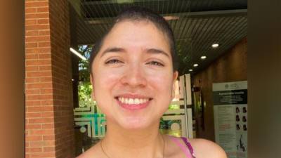 "El dolor es mínimo" : Joven vive con la mitad de su cráneo tras accidente "El dolor es mínimo" : Joven vive con la mitad de su cráneo tras accidente