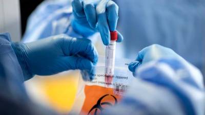 ¿Coronavirus fue fabricado accidentalmente por científicos chinos? ¿Coronavirus fue fabricado accidentalmente por científicos chinos?